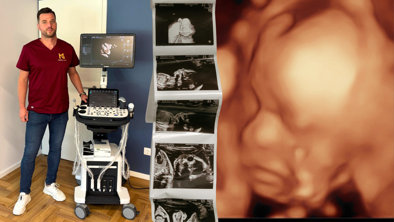 Jenei Lóránd - szülészeti ultrahang géppel