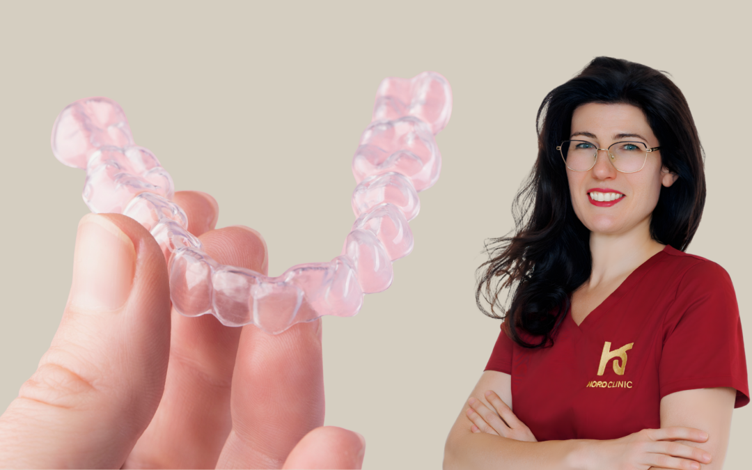 Fogszabályozás: mikor, miért és hogyan érdemes belevágni?